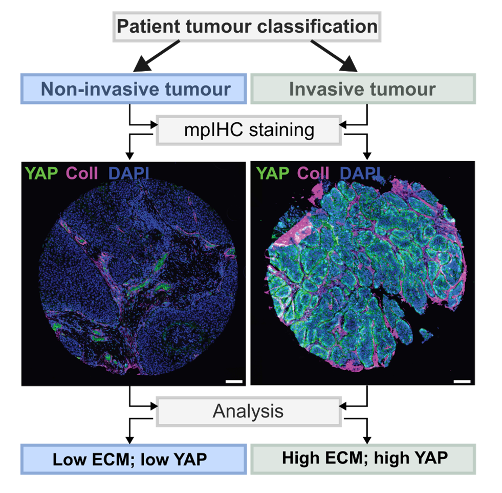 Researchers played music to cells &ndash; aggressiveness of laryngeal cancer decreased