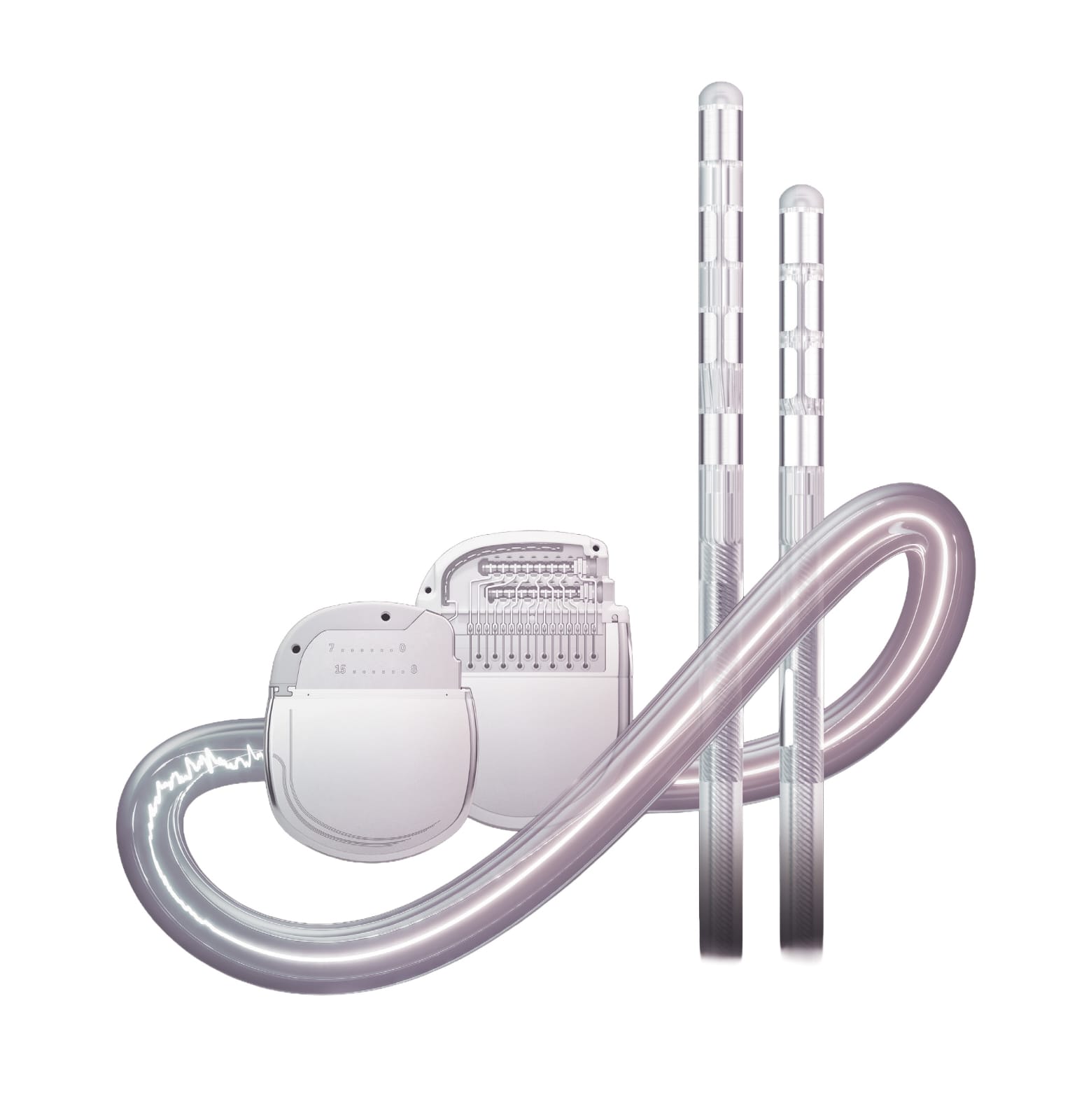 Aster Medcity Kochi Becomes First in India to Launch &ldquo;Smart&rdquo; Adaptive DBS for Parkinson&rsquo;s Disease