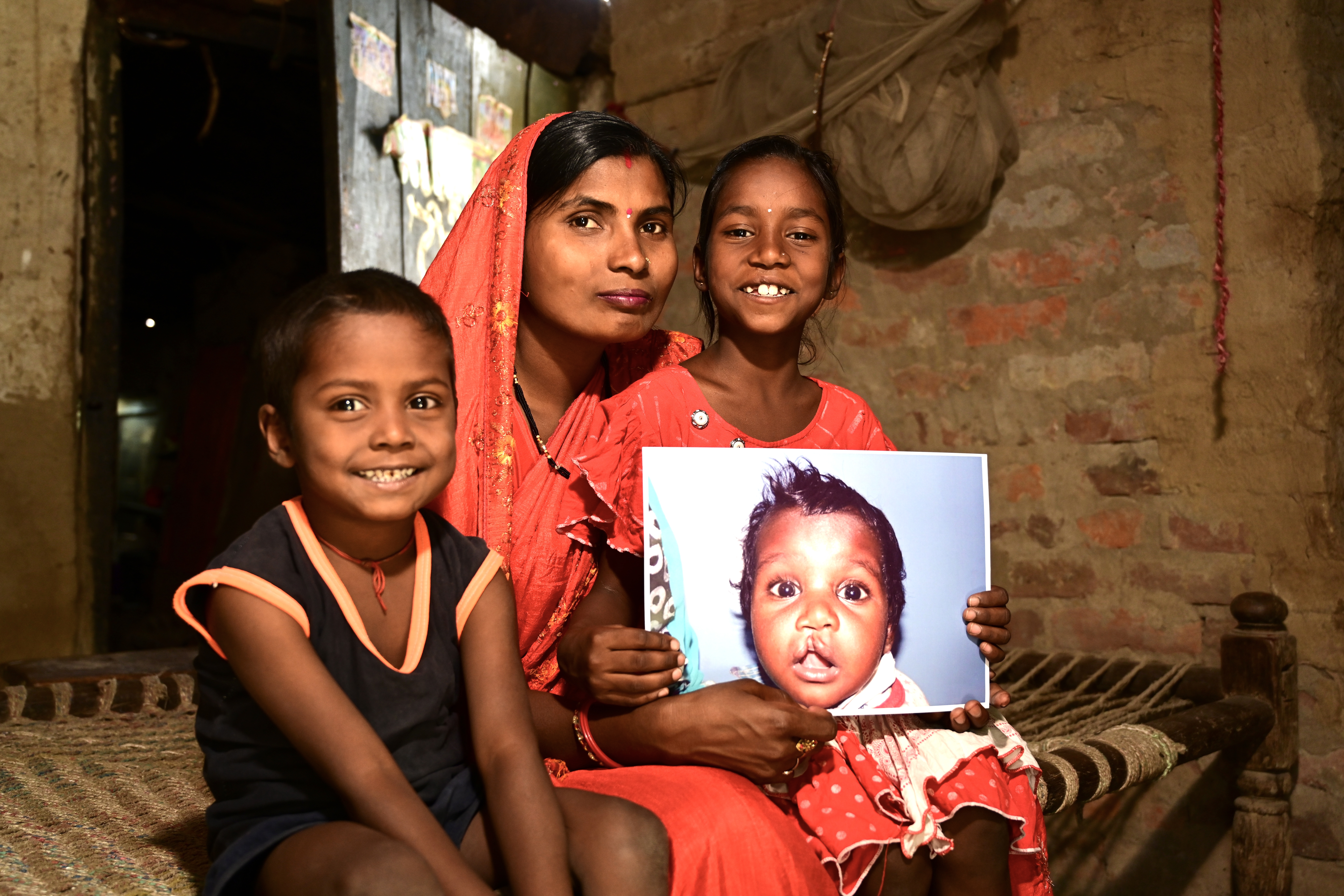 On World Cleft Awareness Day, Smile Train India Marks 800,000 plus Free Surgeries and a Renewed Push for Early Diagnosis of Clefts