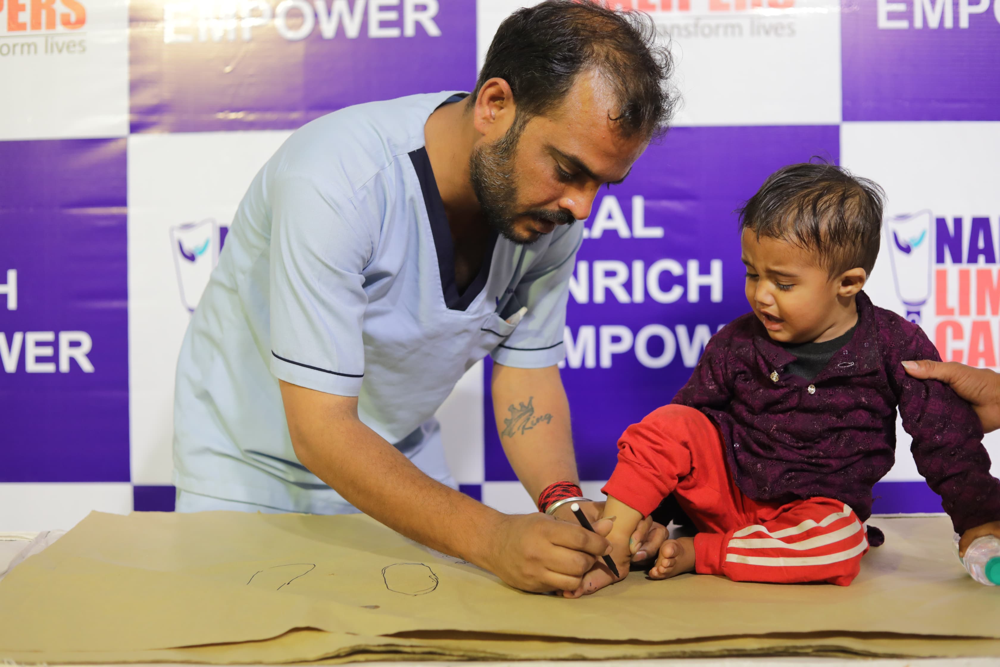 Narayan Seva Sansthan Narayan Seva Sansthan&rsquo;s Free Limb Camp in Agra, 598 Assessed, 108 to Receive Surgery