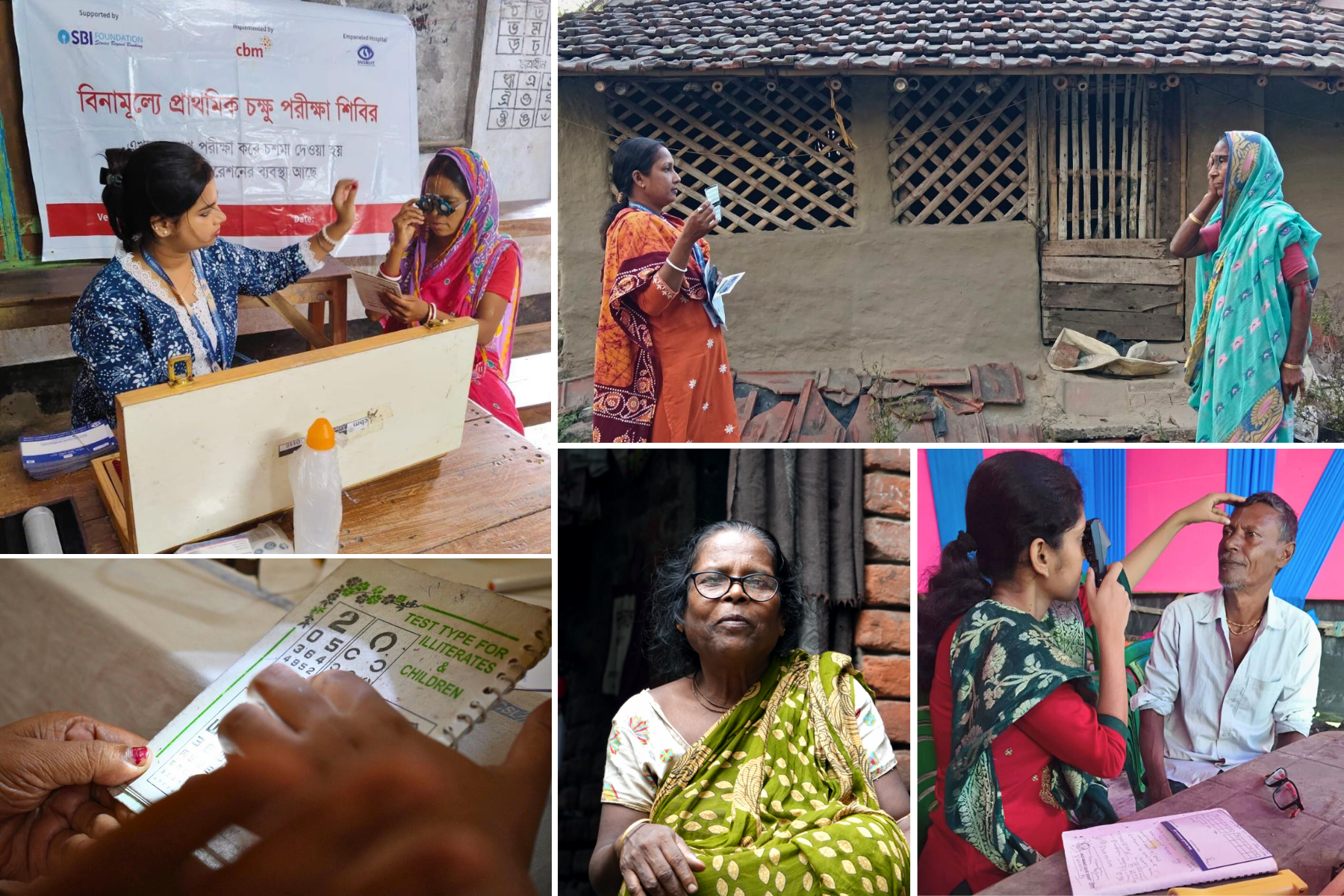 SBI Foundation and CBM India Project Restores Sight to Thousands: 3,000 Cataract Surgeries Supported Across Howrah, West Bengal