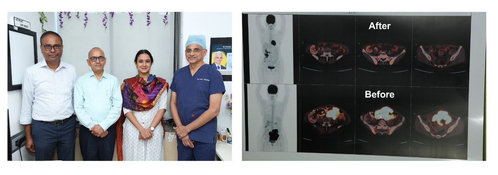 Kidney Transplant Recipient Defeats Cancer