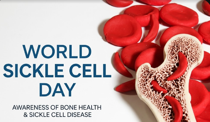 World Sickle Cell Day 2026: From &ldquo;Closing the Survival Gap&rdquo; to a New Era of Cure, Care and Equity